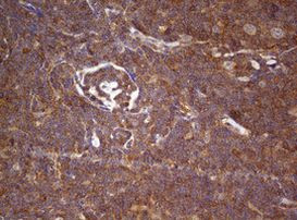 ARL3 Antibody in Immunohistochemistry (Paraffin) (IHC (P))