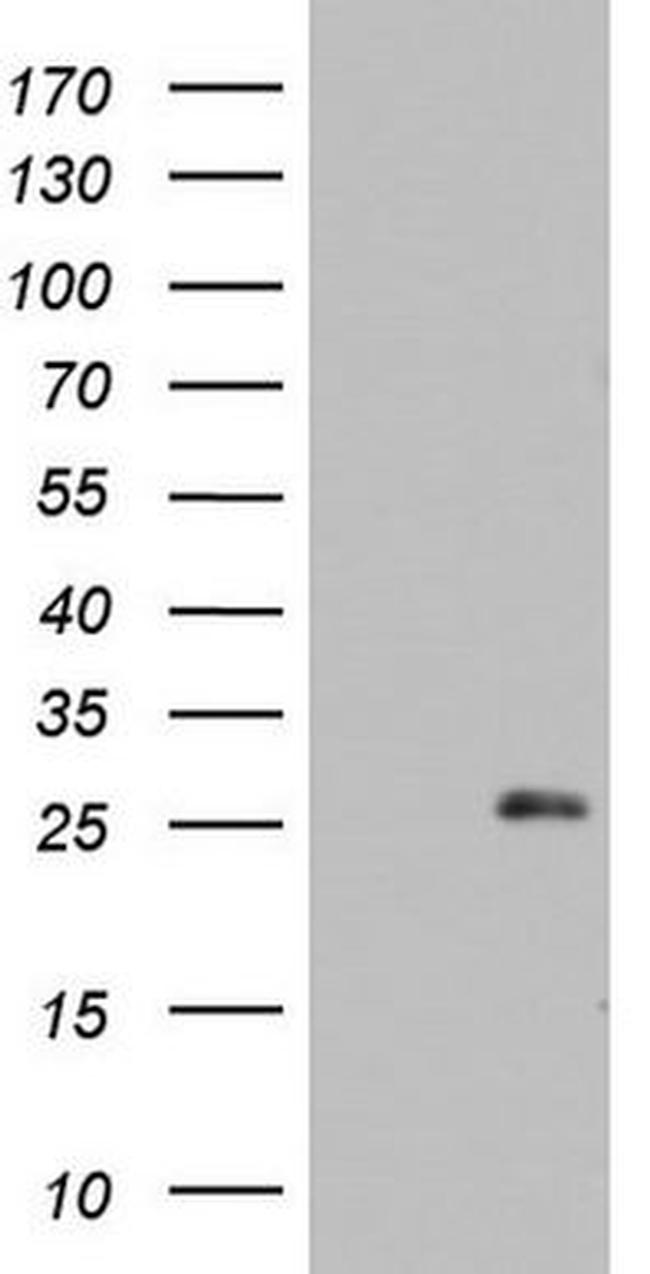 ARL3 Antibody in Western Blot (WB)