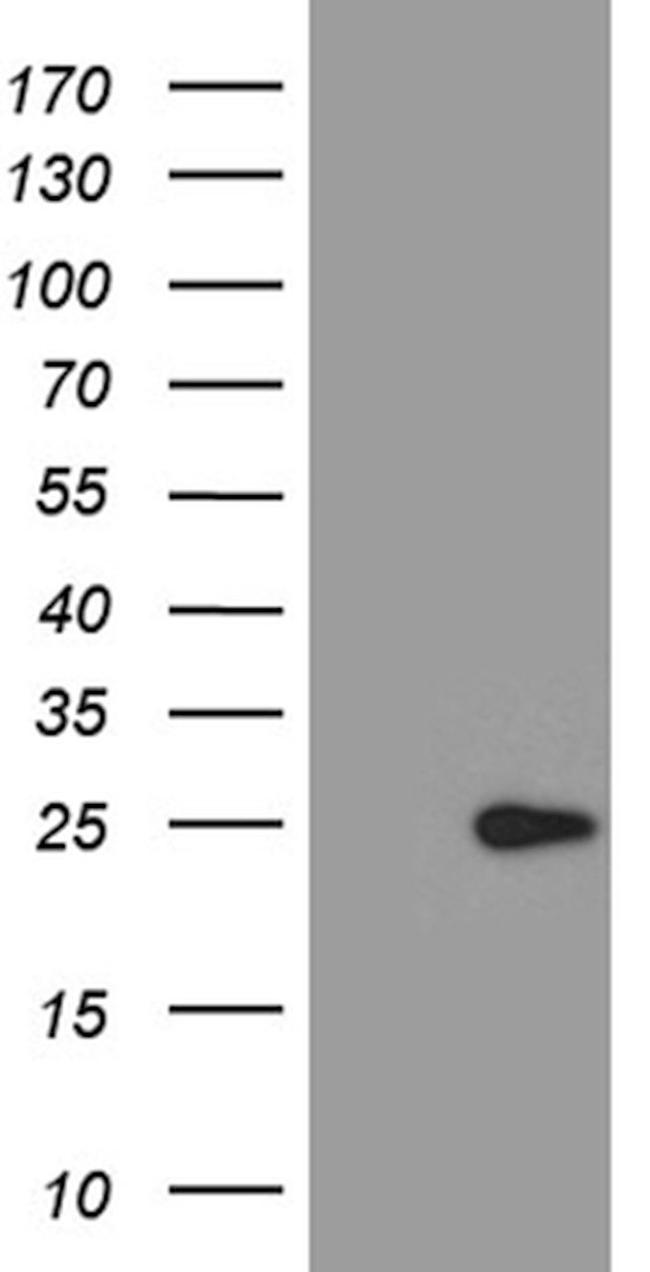 ARL4A Antibody in Western Blot (WB)