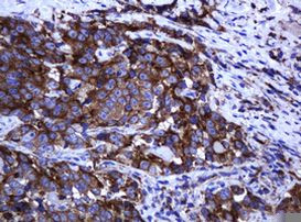 ARMC1 Antibody in Immunohistochemistry (Paraffin) (IHC (P))
