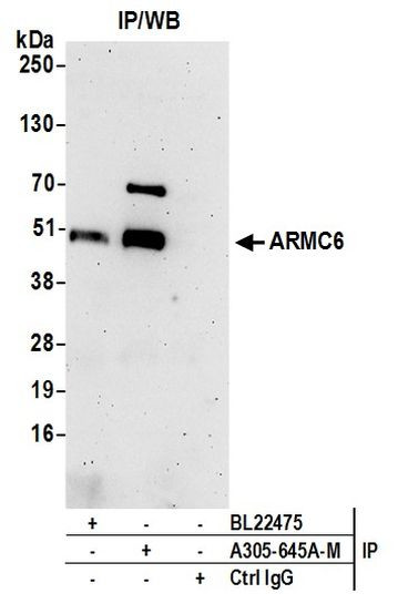 ARMC6 Antibody in Immunoprecipitation (IP)