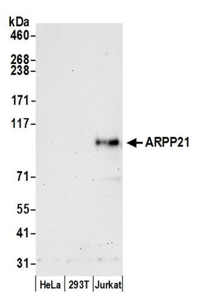 ARPP21 Antibody in Western Blot (WB)