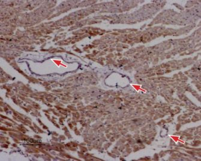 Ryanodine Receptor 2 Antibody in Immunohistochemistry (Paraffin) (IHC (P))