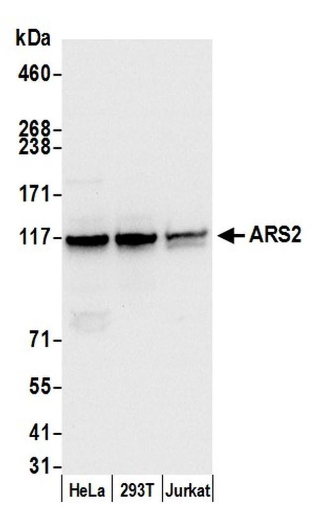 ARS2 Antibody in Western Blot (WB)