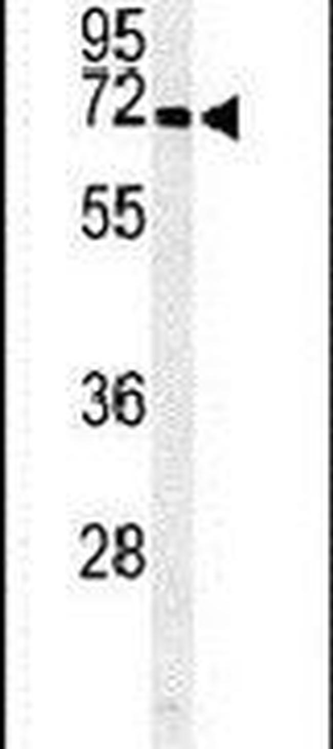 ARSI Antibody in Western Blot (WB)