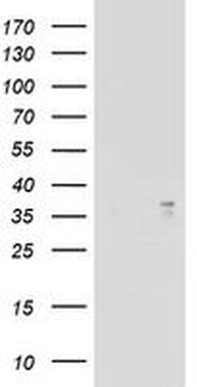 ART1 Antibody in Western Blot (WB)
