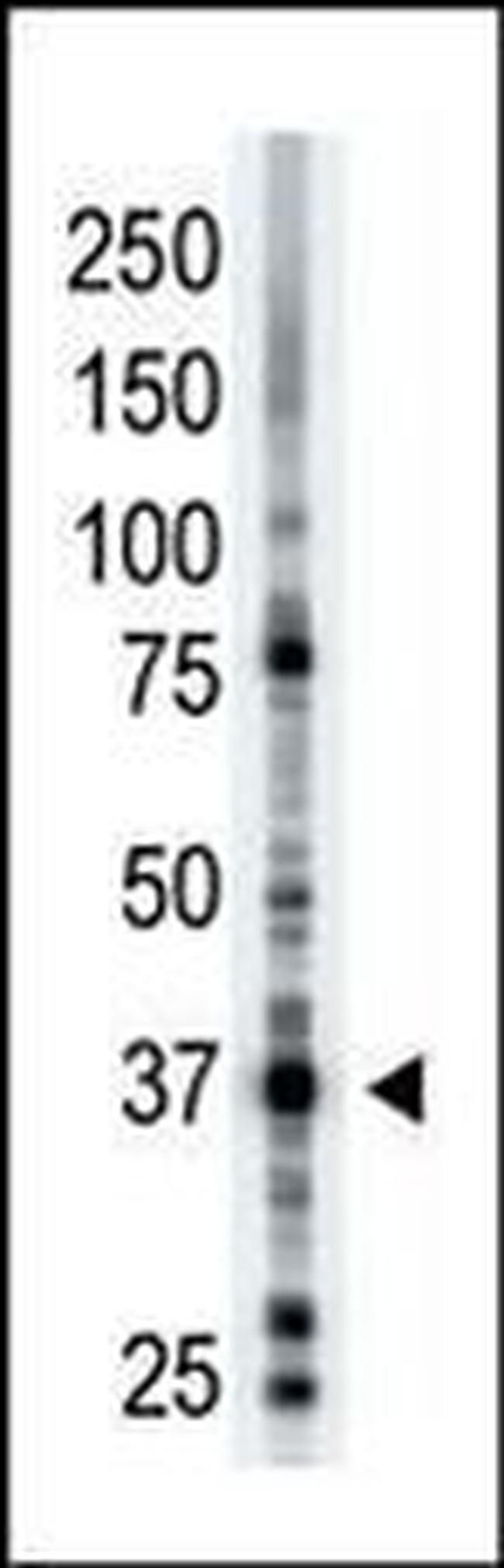 ART1 Antibody in Western Blot (WB)