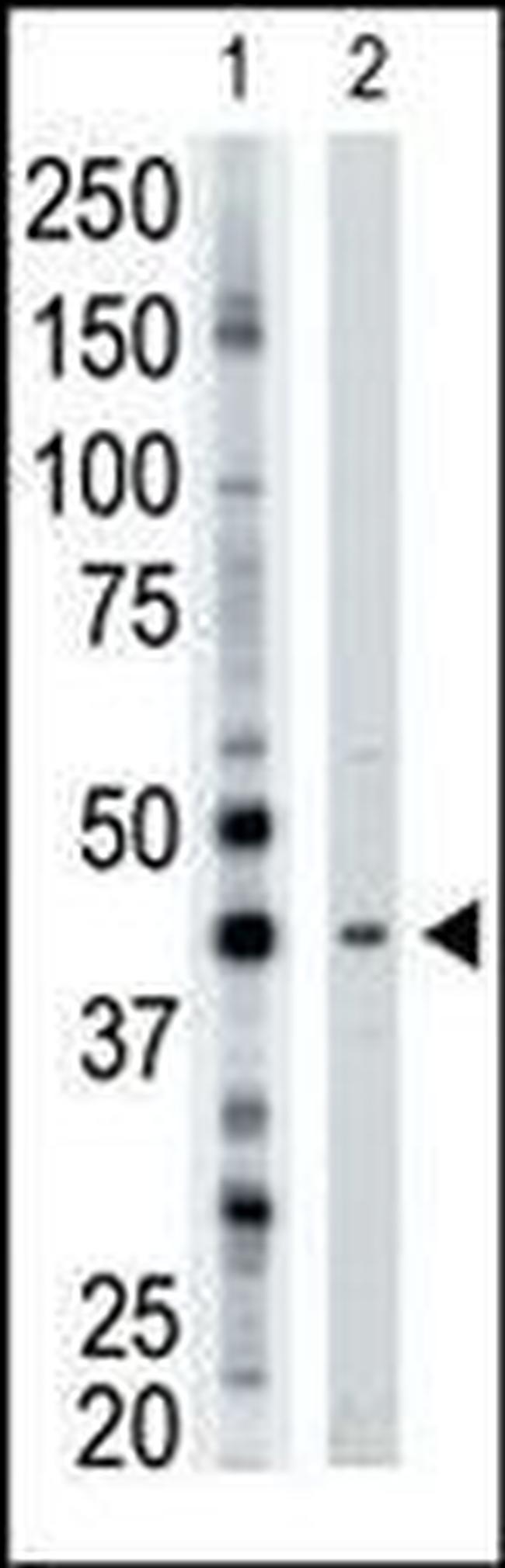 ART3 Antibody in Western Blot (WB)