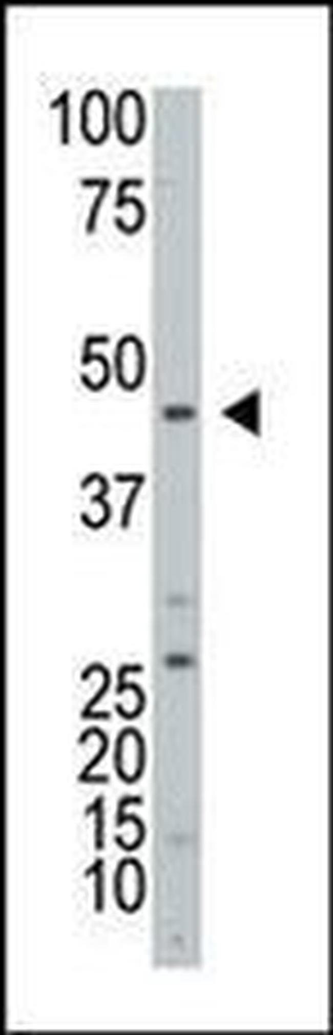 ART3 Antibody in Western Blot (WB)