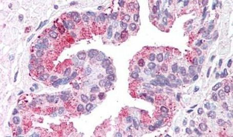 ARTS1 Antibody in Immunohistochemistry (Paraffin) (IHC (P))