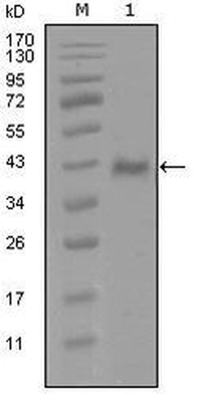 Androgen Receptor Antibody in Western Blot (WB)