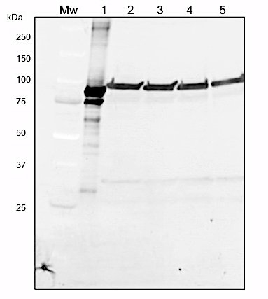 LOX/Lipoxygenase Antibody in Western Blot (WB)