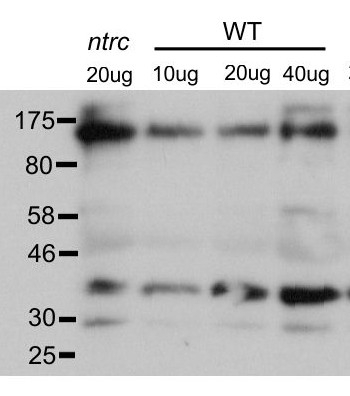 PRK ribulose-5-P-kinase/Phosphoribulokinase Antibody in Western Blot (WB)
