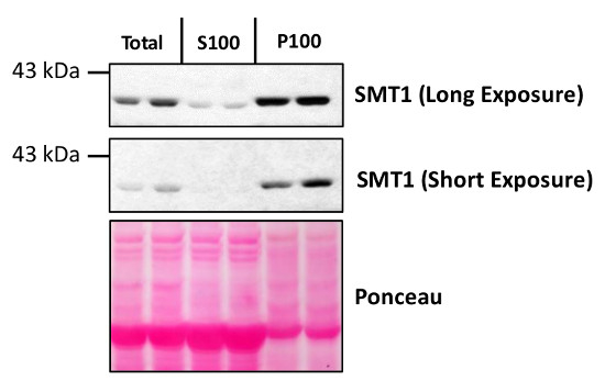 SMT1/Sterol methyltransferase 1 Antibody in Western Blot (WB)