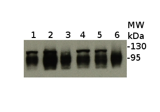 ClpB-P/ClpB3 Antibody in Western Blot (WB)