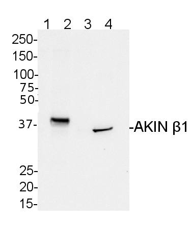 AKINB1/SNF1-related protein kinase regulatory subunit beta-1 Antibody in Western Blot (WB)