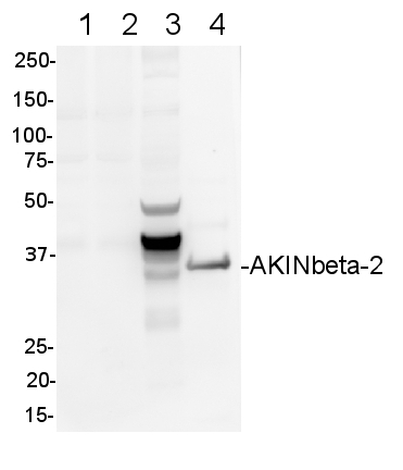 AKINB2/SNF1-related protein kinase regulatory subunit beta-2 Antibody in Western Blot (WB)