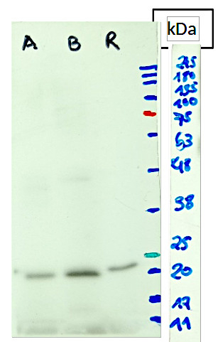 PsbS/22 kDa Lhc-like PSII protein Antibody in Western Blot (WB)