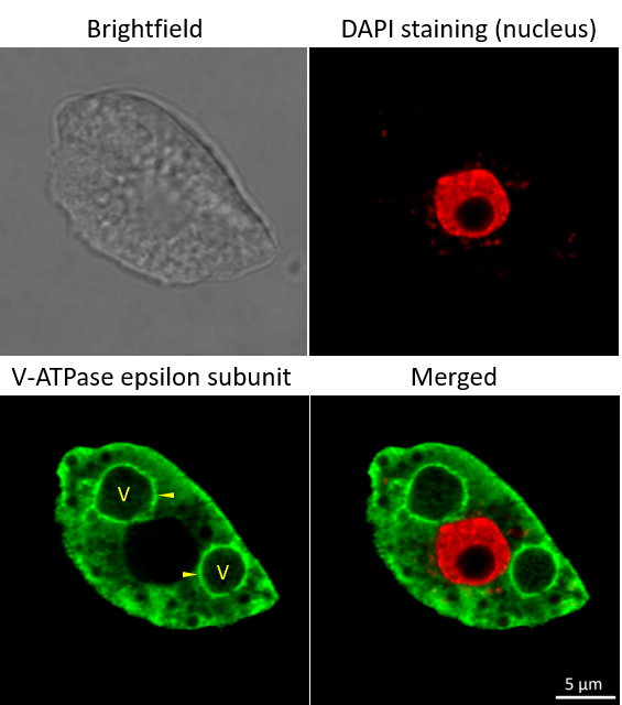 V-ATPase/Epsilon subunit of tonoplast H/ATPase Antibody in Immunocytochemistry (ICC/IF)