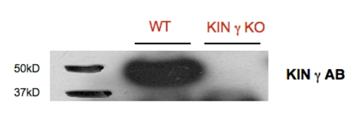 AKING1/SNF1-related protein kinase regulatory subunit gamma 1 Antibody in Western Blot (WB)