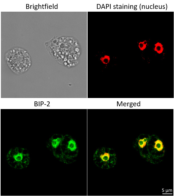 BiP/Lumenal-binding protein Antibody in Immunocytochemistry (ICC/IF)