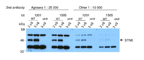 STN8/Serine/threonine-protein kinase STN8 (chloroplastic) Antibody in Western Blot (WB)