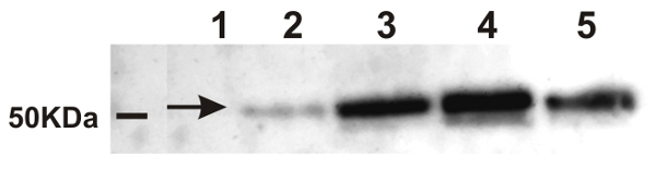 AMY/Alpha-amylase Antibody in Western Blot (WB)