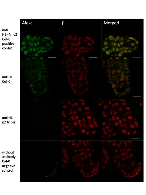 Histone H1 Antibody in Immunohistochemistry (IHC)