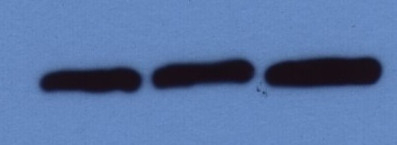 CPK-EF/Calcium-dependent protein kinase EF domain Antibody in Western Blot (WB)