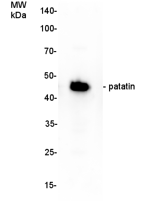 Patatin Antibody in Western Blot (WB)
