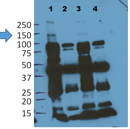 EIN2/Ethylene insensitive 2 Antibody in Western Blot (WB)