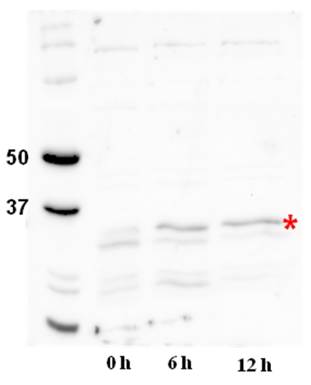 DGAT2A/Acyl-CoA: Diacylglycerol acyltransferase Antibody in Western Blot (WB)
