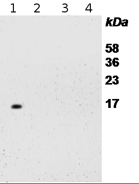 RPS14/40S ribosomal protein S14-1 Antibody in Western Blot (WB)
