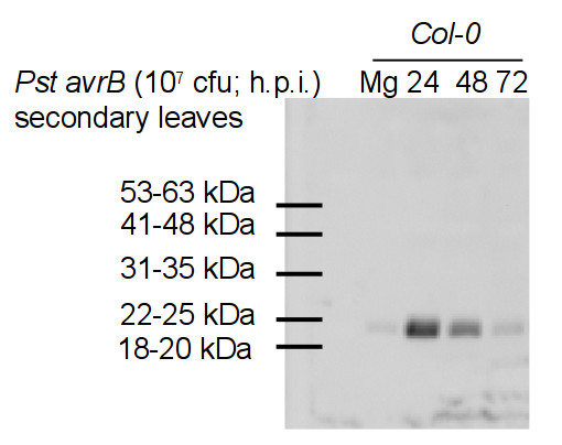 PR-4/Pathogenesis-related protein 4 Antibody in Western Blot (WB)
