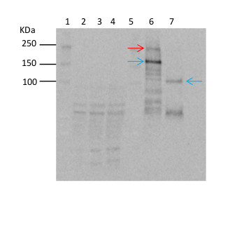 TOR/Target of rapamycin Antibody in Western Blot (WB)