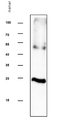 TIP2/Tonoplast intrinsic protein 2.1, 2.2, 2.3 Antibody in Western Blot (WB)