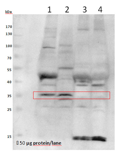 VPS26A/Vacuolar protein sorting 26A Antibody in Western Blot (WB)