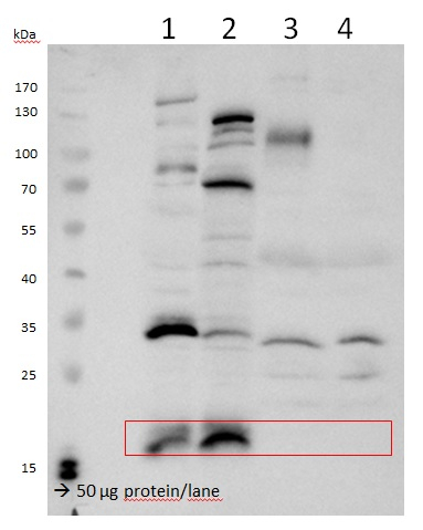 VPS29/Vacuolar protein sorting 29 Antibody in Western Blot (WB)