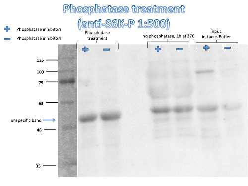 S6K1-2/Ribosomal-protein S6 kinase homolog 1,2 , phosphorylated Antibody in Western Blot (WB)