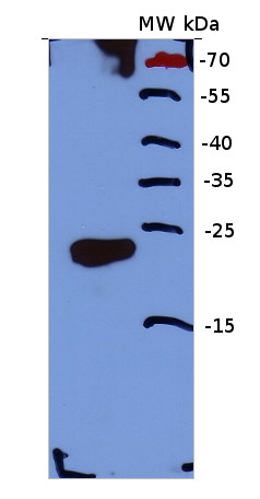 Calcineurin/EF-hand motif Antibody in Western Blot (WB)
