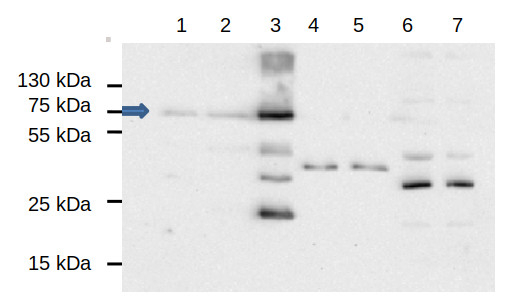 EDS1/Enhanced disease susceptibility 1 Antibody in Western Blot (WB)