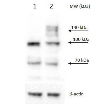 PRP40B/pre-mRNA-processing protein 40B Antibody in Western Blot (WB)