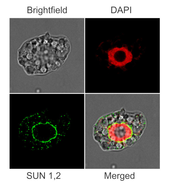 SUN1,2 (nuclear envelope protein) Antibody in Immunocytochemistry (ICC/IF)
