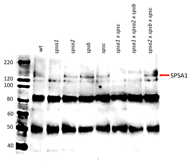 SPSA1/Sucrose phosphate synthase isoform A1 Antibody in Western Blot (WB)