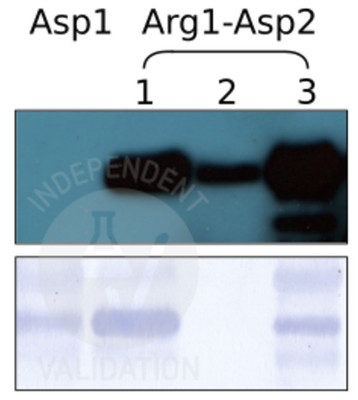 RD/N-terminal arginylation Antibody in Western Blot (WB)
