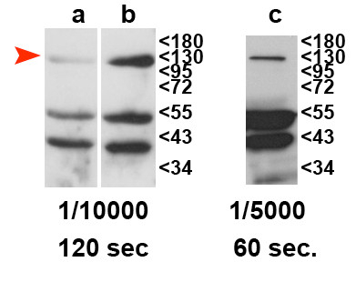 RDR2/RNA-dependent RNA polymerase 2 Antibody in Western Blot (WB)