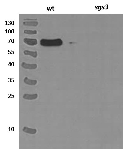 SGS3/Protein suppressor of gene silencing 3 Antibody in Western Blot (WB)