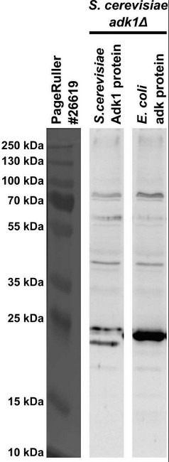 ADK/Adenylate kinase Antibody in Western Blot (WB)