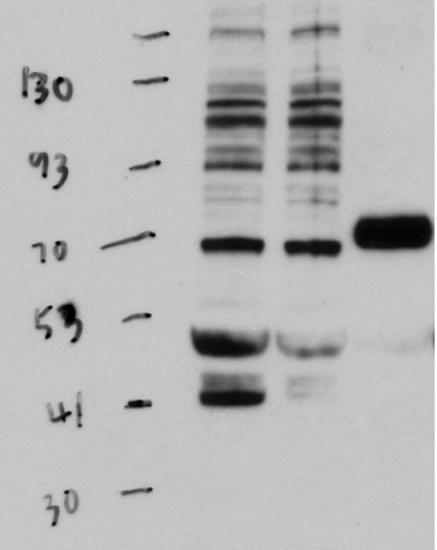 TGA1/TGACG motif-binding factor 1, bZIP transcription factor Antibody in Western Blot (WB)