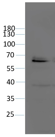 PARP2/Poly (ADP-ribose) polymerase 2 Antibody in Western Blot (WB)
